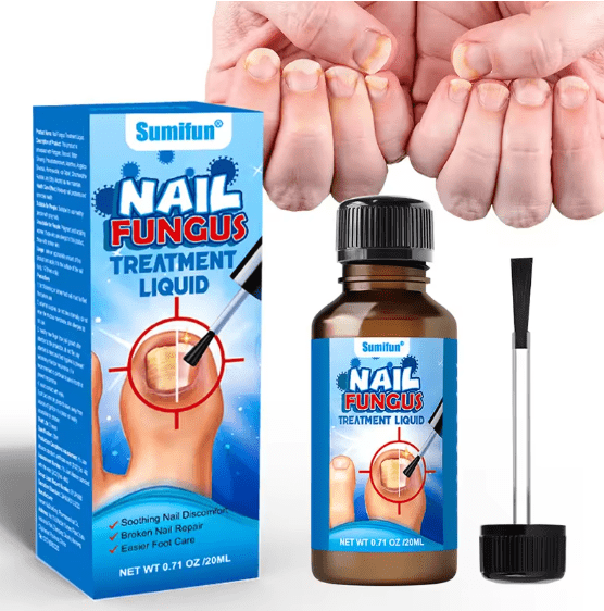 ✨️Sumifun - Nail Fungus Treatment Liquid
30 Days Replacement Warranty